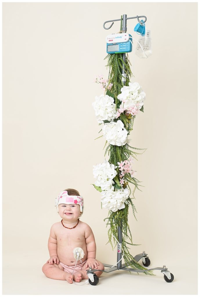 Downs Syndrome Awareness - Rachel Mummert Photography - Hanover, PA - Feeding Tube